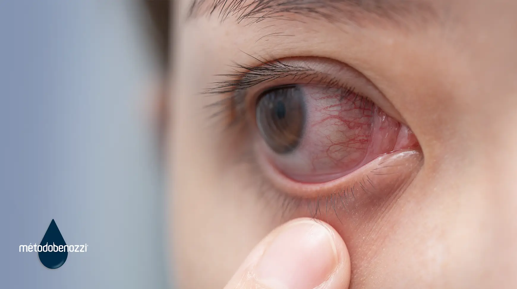 ¿Qué es retinopatía diabética?