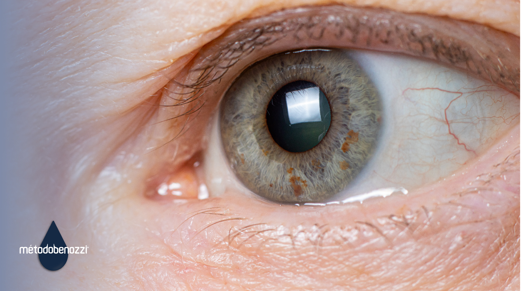 Cristalino: ¿cómo afectan las cataratas a esta parte del ojo?