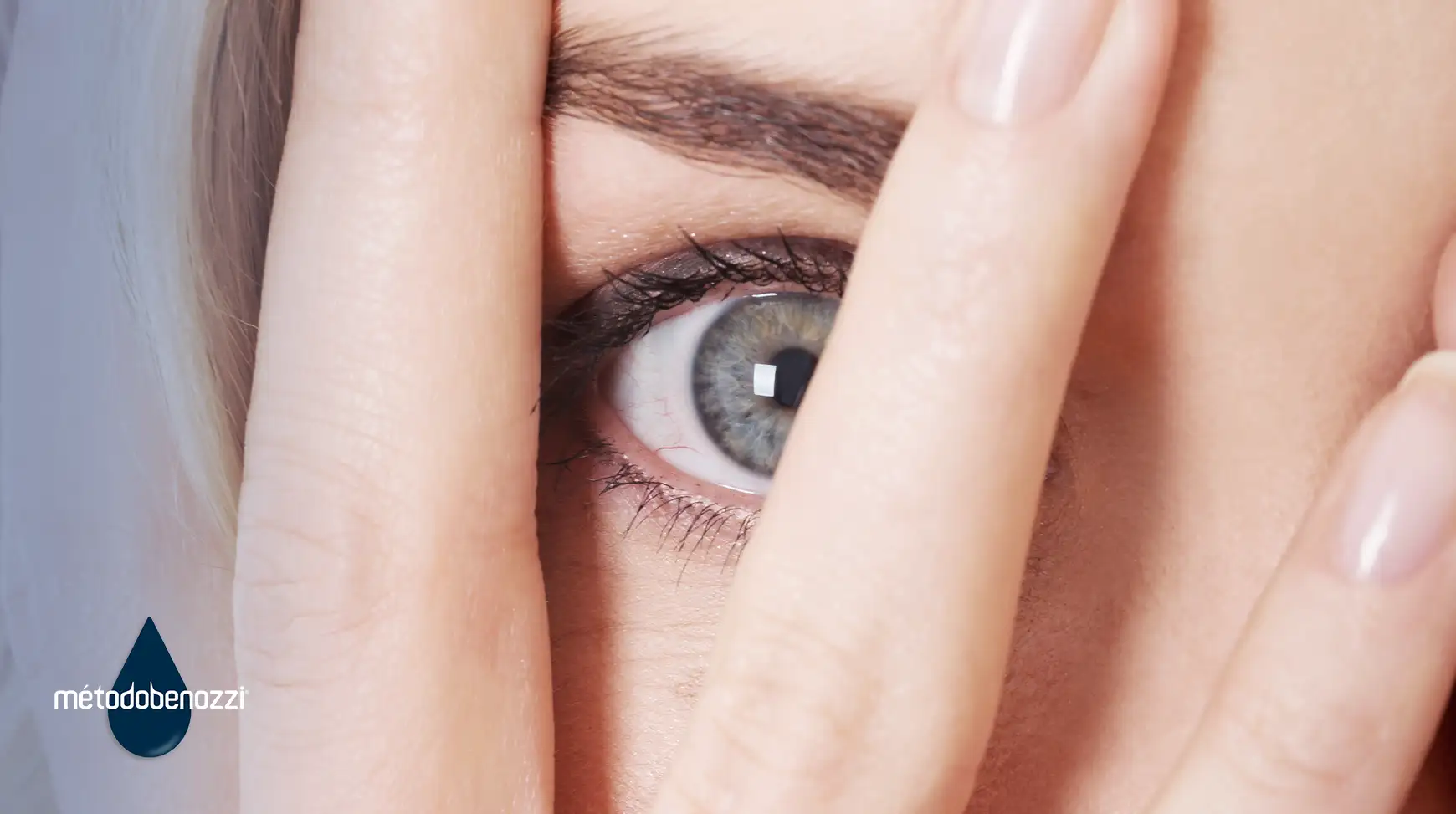 ¿Qué síntomas tiene la queratitis?