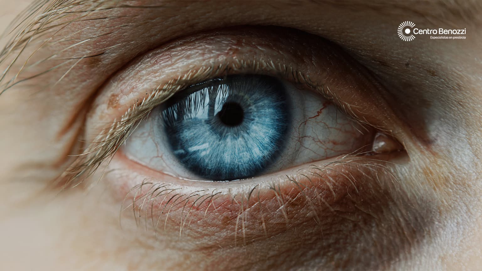 Tipos de lentes intraoculares: diferencias y cuándo se indican